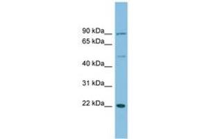 Image no. 1 for anti-DnaJ (Hsp40) Homolog, Subfamily C, Member 12 (DNAJC12) (C-Term) antibody (ABIN6745162)