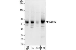 Western Blotting (WB) image for anti-Solute Carrier Family 1 Member 5 (SLC1A5) (AA 450-500) antibody (ABIN7449992)