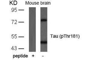 Western blot analysis of extracts from mouse brain tissue using Tau(Phospho-Thr181) Antibody and the same antibody preincubated with blocking peptide. (MAPT antibody  (pThr181))