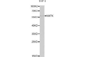 Western blot analysis of extracts of THP-1 cells, using MATK antibody. (MATK antibody)