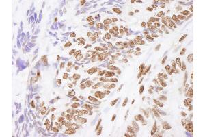 anti-Matrin 3 (MATR3) (C-Term) antibody