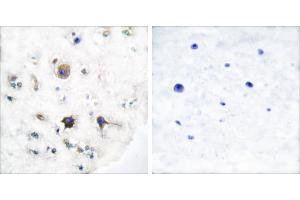 Peptide - +Immunohistochemical analysis of paraffin-embedded human brain tissue using Ephrin-B3 antibody (#C0182).
