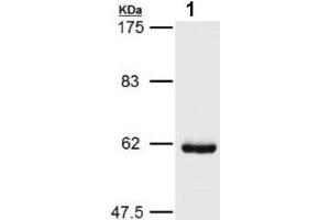 Western blot analysis of HSP60 expression in COLO205 cells (HSPD1 antibody)