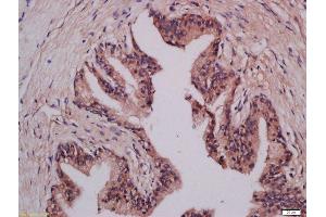 Formalin-fixed and paraffin embedded human prostate tissue labeled with Anti-LMAN1 Polyclonal Antibody, Unconjugated  at 1:300 followed by conjugation to the secondary antibody and DAB staining. (LMAN1 antibody  (AA 31-130))