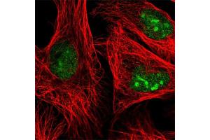 Immunofluorescent staining of human cell line U-2 OS with ADAR polyclonal antibody  at 1-4 ug/mL concentration shows positivity in nucleoli and nucleus but excluded from the nucleoli.