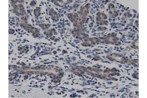 Immunohistochemical staining of paraffin-embedded Human breast tissue using anti-DNAJA2 mouse monoclonal antibody. (DNAJA2 antibody)