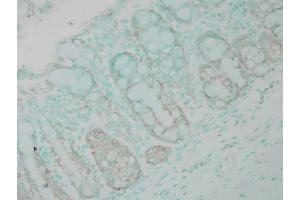 Immunohistochemistry analysis using Rabbit Anti-Ubiquitin Polyclonal Antibody . (Ubiquitin antibody  (FITC))