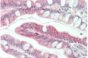 Human Small Intestine: Formalin-Fixed, Paraffin-Embedded (FFPE) (FZD5 antibody  (AA 461-510))