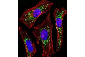 Fluorescent image of Hela cells stained with CYC1 Antibody (Center) (ABIN1944852 and ABIN2838554).
