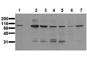 Western Blotting (WB) image for anti-Catenin (Cadherin-Associated Protein), beta 1, 88kDa (CTNNB1) (Core) antibody (ABIN126748) (CTNNB1 antibody  (Core))