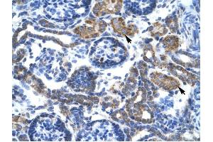 C4BPB antibody was used for immunohistochemistry at a concentration of 4-8 ug/ml to stain Epithelial cells of renal tubule (arrows) in Human Kidney.