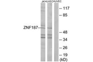 Western blot analysis of extracts from Jurkat/HuvEc cells, using ZNF187 Antibody.