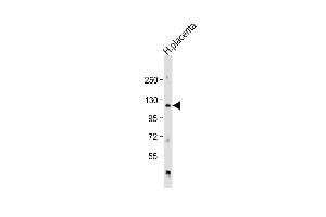 Anti-AD Antibody (Center) at 1:1000 dilution + human placenta lysate Lysates/proteins at 20 μg per lane. (ADAM19 antibody  (AA 207-236))