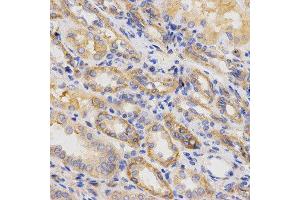 Immunohistochemistry of paraffin-embedded human kidney using ITGB5 antibody at dilution of 1:200 (x400 lens) (Integrin beta 5 antibody  (AA 490-720))