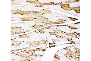 IHC-P: Myoglobin antibody testing of rat skeletal muscle tissue (Myoglobin antibody  (AA 138-154))