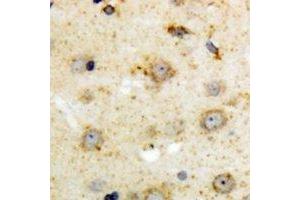 Immunohistochemical analysis of NTR1 staining in human brain formalin fixed paraffin embedded tissue section. (NTSR1 antibody)
