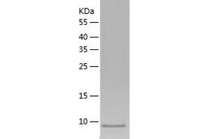 Western Blotting (WB) image for Chemokine (C Motif) Ligand 1 (XCL1) (AA 22-114) protein (His tag) (ABIN7286233) (XCL1 Protein (AA 22-114) (His tag))