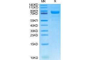 Canine LRRC15 on Tris-Bis PAGE under reduced condition. (LRRC15 Protein (AA 47-565) (His tag))