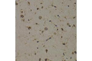 Immunohistochemistry of paraffin-embedded mouse brain using EEF1D antibody at dilution of 1:200 (400x lens).