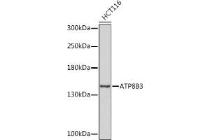 Western blot analysis of extracts of HCT116 cells, using B3 Rabbit pAb (ABIN7265751) at 1:1000 dilution. (ATP8B3 antibody  (AA 600-900))