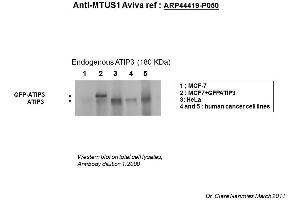 Image no. 2 for anti-Microtubule Associated Tumor Suppressor 1 (MTUS1) (Middle Region) antibody (ABIN502510) (MTUS1 antibody  (Middle Region))