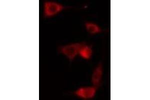 ABIN6275056 staining NIH-3T3 cells by IF/ICC. (DHPS antibody  (Internal Region))