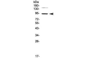 Western blot testing of human HeLa cell lysate with PDE4D antibody at 0. (PDE4D antibody)