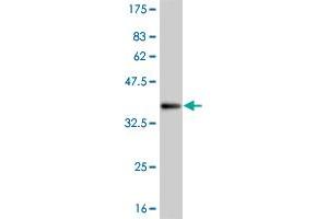 Western Blot detection against Immunogen (35. (WT1 antibody  (AA 349-439))