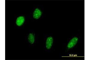 Immunofluorescence (IF) image for anti-PRP18 Pre-mRNA Processing Factor 18 (PRPF18) (AA 1-342) antibody (ABIN522016)