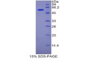 SDS-PAGE (SDS) image for Pregnancy Zone Protein (PZP) (AA 1224-1495) protein (His tag,GST tag) (ABIN2123496) (PZP Protein (AA 1224-1495) (His tag,GST tag))