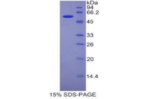 SDS-PAGE (SDS) image for Pregnancy Zone Protein (PZP) (AA 1224-1495) protein (His tag,GST tag) (ABIN2123495)