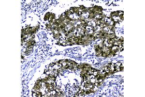 IHC analysis of STUB1 using anti-STUB1 antibody . (STUB1 antibody  (AA 51-303))