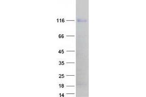 Western Blotting (WB) image for Nuclear Factor of Activated T-Cells, Cytoplasmic, Calcineurin-Dependent 2 (NFAT1) (Transcript Variant D) protein (Myc-DYKDDDDK Tag) (ABIN2727215)
