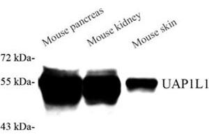 Western blot analysis of UAP1L1 (ABIN7076143) at dilution of 1: 2000