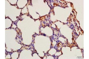 Formalin-fixed and paraffin embedded rat lung labeled with Rabbit Anti-FLT3 (Tyr842) Polyclonal Antibody, Unconjugated  at 1:200 followed by conjugation to the secondary antibody and DAB staining (FLT3 antibody  (pTyr842))