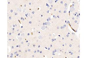 Immunohistochemistry analysis of paraffin-embedded Mouse brain using AQP1 Polyclonal Antibody at dilution of 1:400. (Aquaporin 1 antibody)