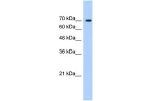 Western Blotting (WB) image for anti-LAS1-Like (LAS1L) antibody (ABIN2461010) (LAS1L antibody)