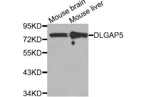 Western blot analysis of extracts of various tissues, using DLGAP5 antibody. (DLGAP5 antibody  (AA 547-846))