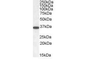 Image no. 1 for anti-Protein Phosphatase 2, Catalytic Subunit, alpha Isozyme (PPP2CA) (C-Term) antibody (ABIN374130) (PPP2CA antibody  (C-Term))