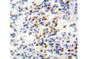 Used in DAB staining on fromalin fixed paraffin-embedded Spleen tissue (GPI antibody  (AA 335-558))