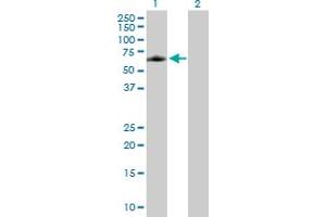 Western Blot analysis of ELK4 expression in transfected 293T cell line by ELK4 MaxPab polyclonal antibody.