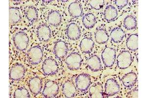 Immunohistochemistry of paraffin-embedded human colon tissue using ABIN7164886 at dilution of 1:100 (PSCA antibody  (AA 12-114))