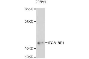 Western blot analysis of extracts of 22RV1 cells, using ITGB1BP1 antibody (ABIN6290512) at 1:3000 dilution. (ITGB1BP1 antibody)