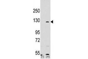 Western Blotting (WB) image for anti-Poly (ADP-Ribose) Polymerase 1 (PARP1) (AA 183-214) antibody (ABIN3032164)