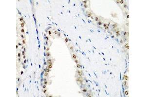 Immunohistochemistry of paraffin-embedded Human prostate using SF3B3 Polyclonal Antibody at dilution of 1:200 (40x lens). (SF3B3 antibody)