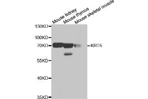 Western blot analysis of extracts of various cell lines, using KRT5 antibody (ABIN5971441) at 1/500 dilution. (Cytokeratin 5 antibody)