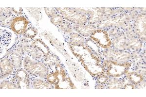 Detection of KLK1 in Human Kidney Tissue using Polyclonal Antibody to Kallikrein 1 (KLK1) (Kallikrein 1 antibody  (AA 25-261))