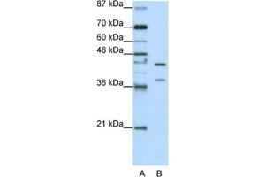 Western Blotting (WB) image for anti-Heterogeneous Nuclear Ribonucleoprotein K (HNRNPK) antibody (ABIN2462118)