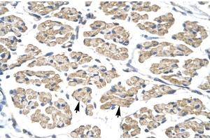 Human Muscle (STAT4 antibody  (N-Term))