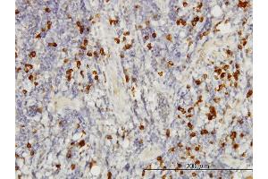 Immunoperoxidase of monoclonal antibody to SMAD3 on formalin-fixed paraffin-embedded human tonsil. (SMAD3 antibody  (AA 120-221))
